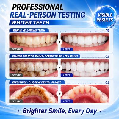 Niacinamide + Charcoal Whitening Toothpaste